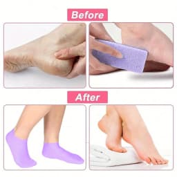 Moisturizing Foot Socks,Silicone Socks for Dry Cracked Feet Women's Foot Socks for Moisturizing,Featuring Massage