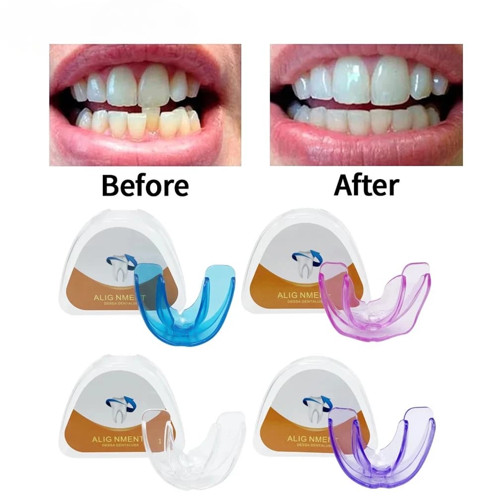 Orthodontic Braces Dental Braces Smile Teeth Alignment Trainer Instanted Silicone Teeth Retainer Mouth Guard Braces Tooth 2026