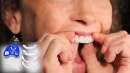 Veneer Snap-on Teeth Kit Fake Temporary Tooth Whitening Replacement Temporary Tooth Replacement Men Women