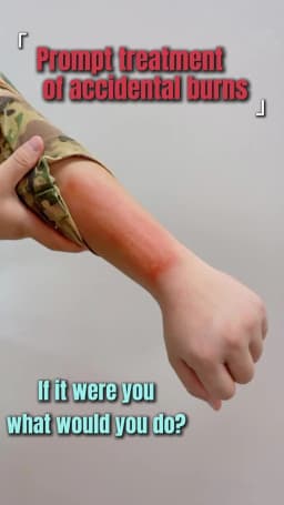 Emergency Burn Care Gel Cooling Soothing Sunburn Relief Scalds Cream - Instant Comfort for Burns