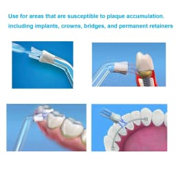 Plaque Seeker Tip for Waterpik Water Flosser Replacement and Other Brand Oral Irrigator Drop Shipping