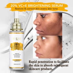 AILKE Vitamin C Set, Reduce Dark Spots, with Lightening Body Lotion, Even Tone Face Cream, Whitening Serum, Brightening Soap
