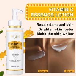 AILKE Vitamin C Set, Reduce Dark Spots, with Lightening Body Lotion, Even Tone Face Cream, Whitening Serum, Brightening Soap