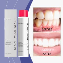 AMZ 237ml Mouthwash Is a Portable Daily Mouthwash That Gently Cleans the Mouth and Leaves a Pleasant Smell