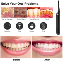 Electric Ultrasonic Dental Scaler 5 Modes Calculus Oral Tartar Remover Tooth Stain 9 Levels Cleaner Teeth Whitening Oral Care