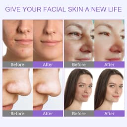 Professional Hydro Water Oxygen Machine Jet Peel Oxy Spray Facial Machine Face Cleaning Lifting Dermabrasion Skin Care Beauty