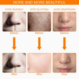Foreverlily 7 Colors Light LED Facial Skin Care Mask With Neck Skin Rejuvenation Treatment Beauty Anti Acne Therapy Whitening