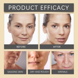 Advanced Bee Venom Face Cream - Nature's Botax for Instant Lifting & Firming,Anti-Aging Moisturizer with Manuka Honey & Collagen