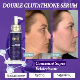 AILKE Double Glutathione Whitening Essence, Moisturizing, Removes Dark Spots, Even Skin Tone Serum For All Skin Types, 100ml
