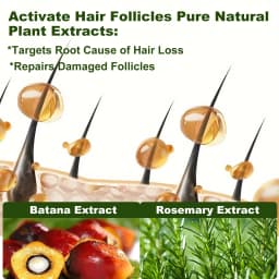 Tgideas Rosemary Batana Oil Shampoo - Promotes Hair Growth, Strengthens Hair Strands, Cleanses Hair, Contains Natural Extracts to