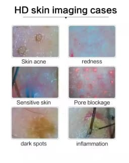 9 Inch HD Skin Hair Scalp Analyzer Detector 50X‑200X Magnification Skin Diagnosis Machine Multispectral Facial Skin Condition Tester For Beauty Salon Home Use Detect Acne Redness Dark Spots Pore Blockage Scalp Hair Follicle Health Analysis Device US EU Pl