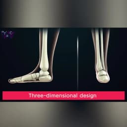 Princepard Children's Orthopedic Sandals Summer Corrective AFO Leather Shoes with Arch Support Thomas Sole EU 20-35