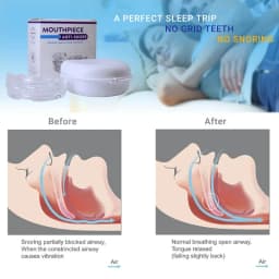 Adjustable Anti-Snoring Mouth Guard Mouthpiece Sleeping Devices Bruxism Snoring Stopper Improve Sleep Mouthpiece Night Time Teeth Mouthguard & Sleeping Bite Guard for Bruxism and Stop Snoring