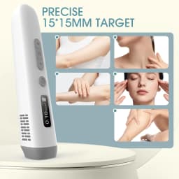 308nm UVB Light Therapy Device Handheld Narrowband Phototherapy Lamp with Adjustable Dose Digital Display 15x15mm Targeted Care Area Rechargeable Portable Home Use for Hands Arms Legs Neck Body Skin Care Includes Protective Glasses