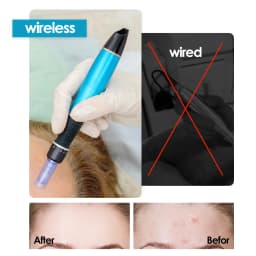 Dr Pen Ultima A1 Microneedling Professional Derma Pen A1 Wireless Button 5 Levels Adjustment Scars Stretch Marks Helpful