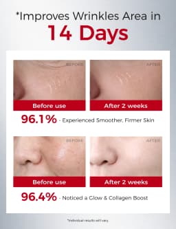 NING Retinol Anti-Aging Serum 30ml X 3 – Starter-Friendly Night Essence for Wrinkle Repair, Firming & Youthful Glow