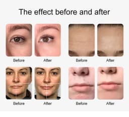 New 10 In 1 Aqua Peeling Lift Skin Bubble Moisturizer Oxygen Machine Skin Care Cleansing Facial Equipment