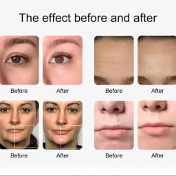 12 in 1 Water Oxygen Hydro Machine Face Lifting Deep Cleaning Dermabrasion Aqua Peeling Machine Skin Rejuvenation Small Bubble