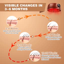Wireless Hair Growth Laser Cap 120 Diodes 850nm 660nm Anti Hair Loss Stress Relief Infrared Light Relaxation Therapy 4 Levels