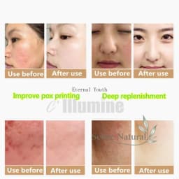 Pure Snail Mucus 100g - Intense Anti-Aging, Firming & Rejuvenating Facial Essence
