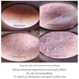 10pcs Sponge Microcrystal Freeze-dried Powder Collagen Regeneration Natural Biological Extract Sponge Spicules Skin Cell Renew