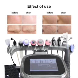 AOKO 12 in 1 Multifunctional Machine Deep Cleansing Blackhead Remove Device Face Care Water Oxygen Hydrogen For Home SPA Use