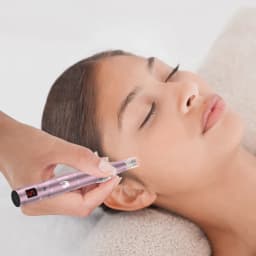 Homeuse Wilreless Ultima Microneedling Pen Professional Dermapen With 12pcs Tattoo Needles