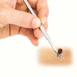 1/2pcs Stainless Steel Tick & Flea Remover for Cats and Dogs - Professional-Grade Prong Design with Ergonomic Textured Grip