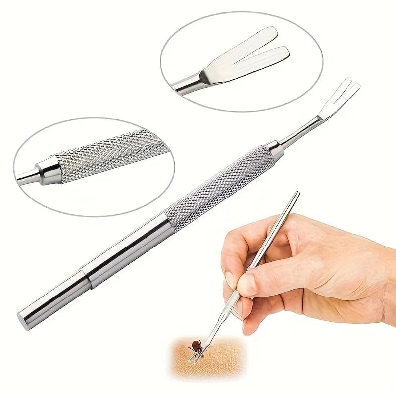 1/2pcs Stainless Steel Tick & Flea Remover for Cats and Dogs - Professional-Grade Prong Design with Ergonomic Textured Grip