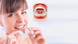 Dental Accessories 3 Stages Dental Braces Teeth Trainer Alignment Mouthpiece Tooth Orthodontic Brace Straightener For Adults