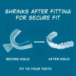 1/4/8pcs Anti Snoring Bruxism Sleeping Mouth Guard Tray Stop Teeth Grinding Sleep Aid Night Guard Gum Shield Mouth Health Care