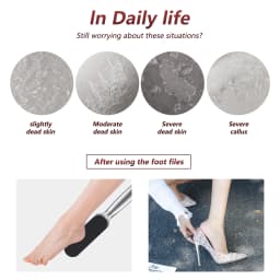 TP 1/20PCS Foot Rasp Profession Feet Care For Hard Dead Skin Callus Remover Pedicure File Replacement For Stainless Steel Handle