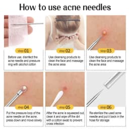 11Pcs Acne Needle Blackhead Clip Remover Extraction Pore Black Head Clean Face Skin Care Cleansing Needle Blemish Removal Tool