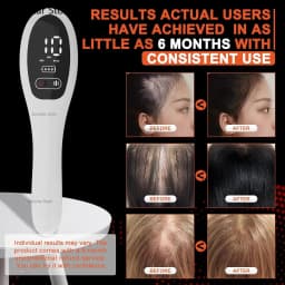 Electric Laser Hair Growth Comb Anti Hair Loss Therapy Comb Infrared 650nm 470nm LED Red Light Vibration Massage Hair Care Brush