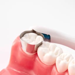 10/50Pcs Dental Pro Matrix Bands Easyinsmile Pre Formed Sectional Contoured Matrice Bands Curved&Standard Adjust System