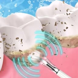 Tartar Remover Electric Teeth Cleaner Set Multi-function Rechargeable Teeth Cleaner 5 Mode Waterproof