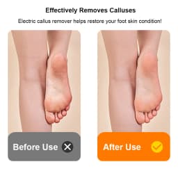 Electric Foot Grinder Automatic Foot Callus Remover Rechargeable Portable Foot Polishing Dry Hard Dead Skin Cracked Removal Tool