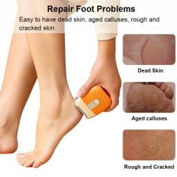 Electric Foot Grinder Automatic Foot Callus Remover Rechargeable Portable Foot Polishing Dry Hard Dead Skin Cracked Removal Tool