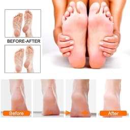 Rechargeable Electric Foot File 1+10 Set Callus Remover Machine Pedicure Device Foot Care Tools For Heels Remove Dead Skin Black