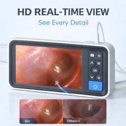 Digital Otoscope with 4.5 Inches Screen 3.9mm Ear Camera with 6 LED Lights 32GB Card Ear Wax Removal Tool Specula and 2500 mAh