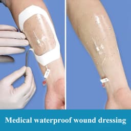 50Pcs Medical Transparent IV Cannula PU Film Sterile Waterproof Self-adhesive Wound Dressing Indwelling Needle Catheter Fixation