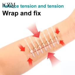 Zipper Tie Wound Closure Patch Hemostatic Patch Wound Fast Without Suture Zipper Outdoor Band-Aid Portable Quick Clot Wound