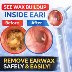 Ear Cleaner Camera with Screen 1080P Otoscope Ear Wax Removal Tool for Kids Adults & Pets 1.8’’ Screen LED Light Safe Ear Picker