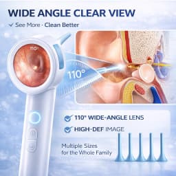 Ear Cleaner Camera with Screen 1080P Otoscope Ear Wax Removal Tool for Kids Adults & Pets 1.8’’ Screen LED Light Safe Ear Picker