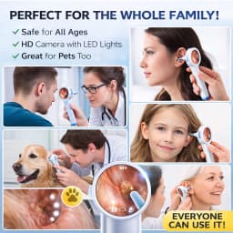 Ear Cleaner Camera with Screen 1080P Otoscope Ear Wax Removal Tool for Kids Adults & Pets 1.8’’ Screen LED Light Safe Ear Picker