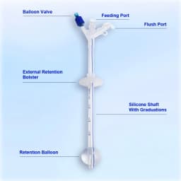 Califed Silicone Gastrostomy Tube Multi Functional Connector X-Ray Medical PEG Tube With Balloon Gastrostomy Surgical Equipment