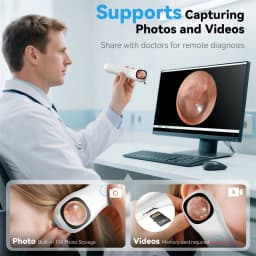 1080P HD Ear Camera 5-in-1 Smart Detector with Screen Ear Scoop Set 6 Replacement Ear Scoops 12 Replacement Check Heads Ear Tool