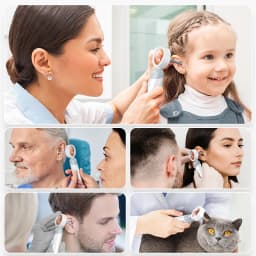 1080P Visual Ear Camera Ear Mouth Check 2M Pixels Camera Ear Wax Cleaner Camera for Ears Nose Skin Support 90° Rotating Heads