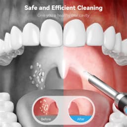 Visual Tonsil Stone Cleaner with Camera and Light 5pcs Heads USB Rechargeable Compatible with IOS and Android Simple and Safty