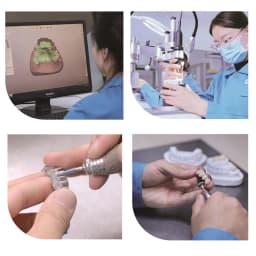 OEM Custom Dentures Fixed Restorations CAD/CAM Multilayered Zirconia IPS e.Max Veneer Post PFM Co-Cr Alloy FMC Bridge